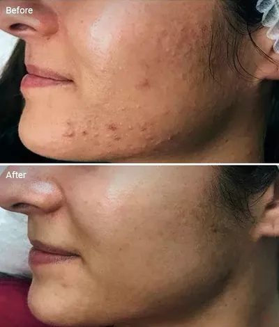 Basic Skincare